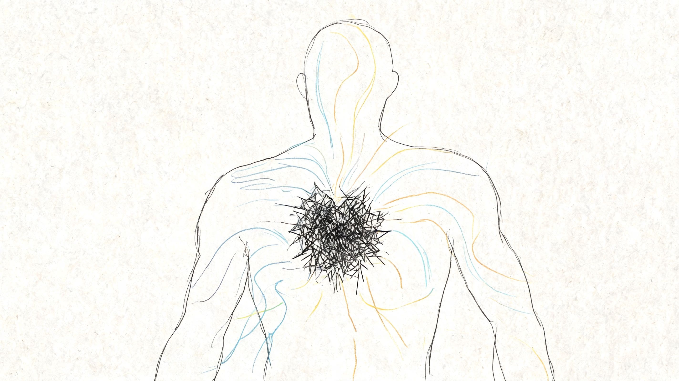 Charcoal sketch of a human torso with tangled scribbles over the chest symbolizing anxiety and physical stress